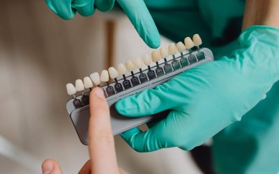 Tandblekning bäst i test – metoderna som verkligen fungerar